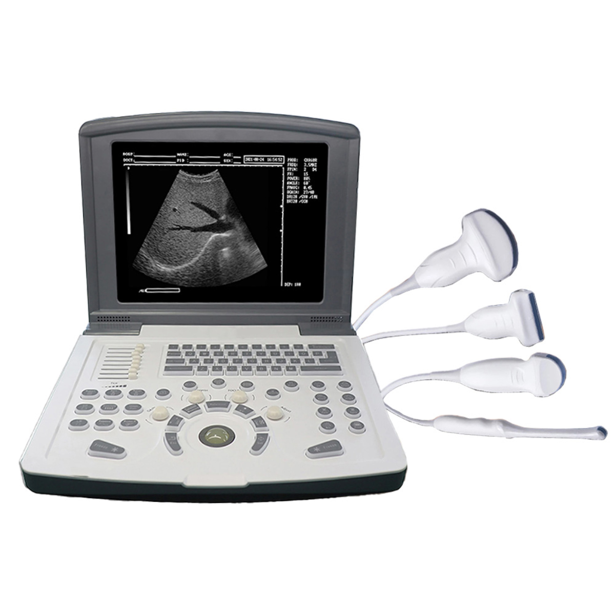 Air Essence™ UltraLite L2 aparat USG – profesjonalny przenośny ultrasonograf