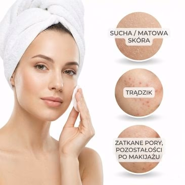 Kobieta z ręcznikiem na głowie używa wacika na twarzy, a wstawki podkreślają suchość skóry, trądzik i zatkane pory. Obraz z polskim logo promuje Air Essence™ Hydra Facial Therapy ELITE - urządzenie do hydradermabrazji.